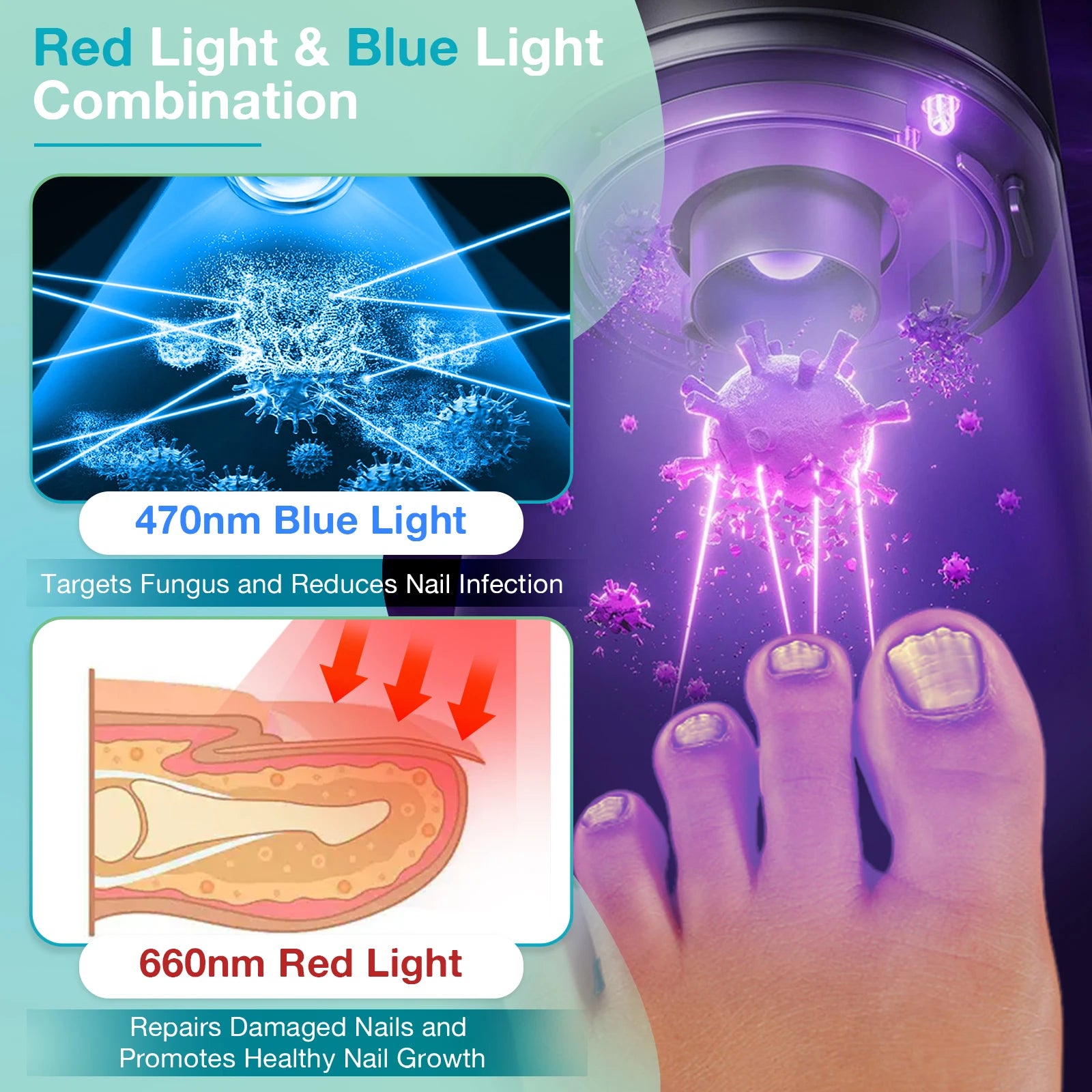 20W Nail Fungus Cleaning Device for Multiple Fingers&Toes 650nm470nm Wireless Digital Display 3/5/7/10 Minute Sessions Nail Care